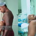 Saiba quanto custou a lipo ultra HD de Davi Brito imagem