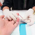Governo Trump encerra programa de pesquisa da vacina contra o HIV imagem
