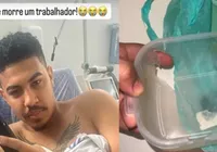 Barbeiro é salvo da morte por marmita após levar tiro nas costas imagem