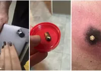 Notebook 'salva' motociclista baleado durante assalto