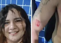 Revolta com traição, mulher ataca marido com mordidas e acaba presa imagem