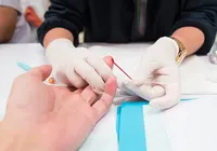 Governo Trump encerra programa de pesquisa da vacina contra o HIV