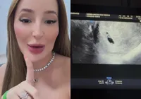 Suposta amante de Neymar mostra ultrassom após confirmar gravidez imagem