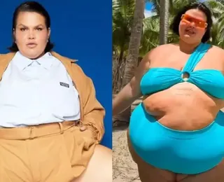 Equipe de Thais Carla explica sumiço da dançarina após cirurgia