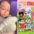 Baiana que enfrentou doença rara vira personagem da Turma da Mônica imagem