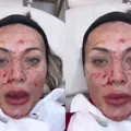 Andressa Urach aparece ensanguentada e choca internautas imagem