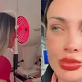 Andressa Urach pode ficar cega após cirurgia para mudar cor dos olhos imagem
