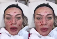 Andressa Urach aparece ensanguentada e choca internautas imagem