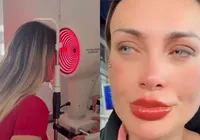 Andressa Urach pode ficar cega após cirurgia para mudar cor dos olhos imagem