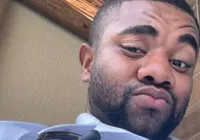 Davi Brito faz harmonização facial e resultado impressiona imagem