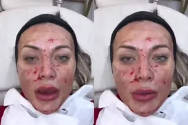 Andressa Urach aparece ensanguentada e choca internautas - Imagem
