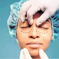 Blefaroplastia conquistou o topo do ranking das operações plásticas imagem