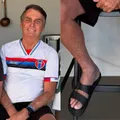 Bolsonaro surge sorridente e exibe tornozeleira eletrônica; veja imagem