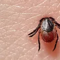 Cantor famoso pega doença grave causada por carrapato contaminado imagem
