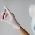 Brasil deve ter 12,2 mil casos de leucemia por ano até 2028 imagem
