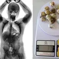 Preso é flagrado com maconha no intestino em presídio na Bahia imagem