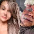 Vítima de ataque brutal no elevador vai precisar de reconstrução facial imagem