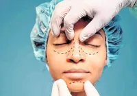 Blefaroplastia conquistou o topo do ranking das operações plásticas imagem