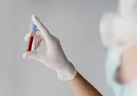 Saiba quanto tempo você tem de vida com um simples exame de sangue