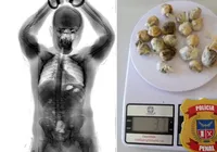 Preso é flagrado com maconha no intestino em presídio na Bahia