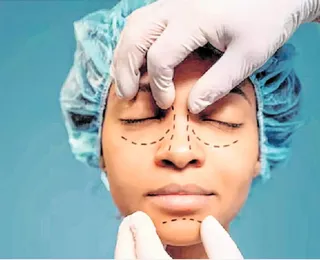 Blefaroplastia conquistou o topo do ranking das operações plásticas