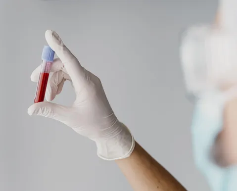 Brasil deve ter 12,2 mil casos de leucemia por ano até 2028
