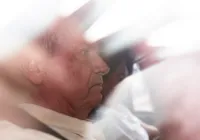 Após passar mal, Bolsonaro é submetido a novo procedimento médico