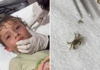 Menino tem caranguejo vivo retirado do ouvido após mergulho no mar