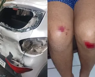 "Meu filho depende de mim", desabafa motorista vítima de emboscada