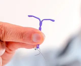 Mutirão oferta 300 vagas para inserção gratuita de DIU e anticoncepcional