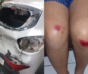 "Meu filho depende de mim", desabafa motorista vítima de emboscada - Imagem