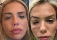 Apresentadora da Globo é infectada por bactéria que leva à cegueira imagem
