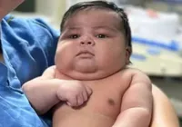 Bebê nasce com mais de 6kg e mãe leva 55 pontos no Brasil