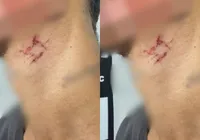 Jovem é resgatado após ser usado como escravo sexual durante um ano imagem