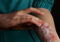 Mulher tem quase 60% do corpo queimado após ritual religioso na Bahia