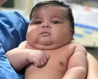 Bebê nasce com mais de 6kg e mãe leva 55 pontos no Brasil
