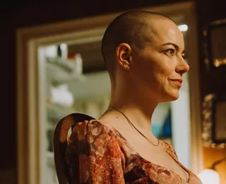 Filme de Emma Stone tem pré-estreia só para quem raspar a cabeça