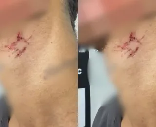 Jovem é resgatado após ser usado como escravo sexual durante um ano