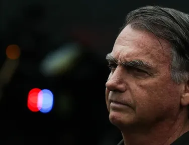 Bolsonaro passará por perícia médica nesta quarta-feira - Imagem
