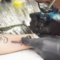 Tatuagem removida a laser: saiba para onde vai a tinta no corpo imagem