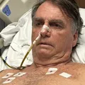 Bolsonaro deixa hospital e volta para sede da PF em Brasília imagem