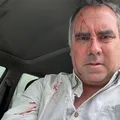 Pré-candidato à Presidência do Peru sofre ataque armado imagem