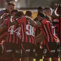 Vitória x Remo: onde assistir e prováveis escalações imagem