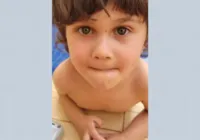 Menino de 4 anos que caiu de prédio quebrou as duas pernas imagem