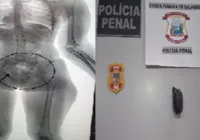 Flagrada no Raio-X: mulher é presa ao entrar em presídio com drogas nas partes íntimas