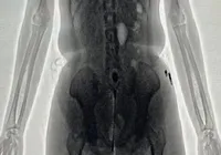 Mulher é presa com droga nas partes íntimas em presídio da Bahia