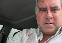 Pré-candidato à Presidência do Peru sofre ataque armado imagem