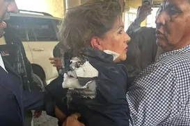 Vídeo: deputada é atingida por explosivo na cabeça durante entrevista - Imagem