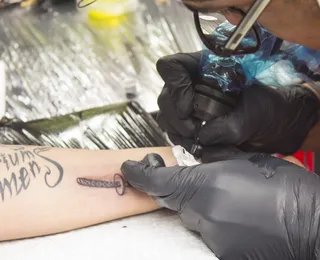 Tatuagem removida a laser: saiba para onde vai a tinta no corpo