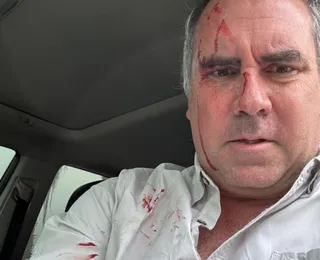 Pré-candidato à Presidência do Peru sofre ataque armado